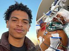 Texas man, 25, once gawked at by girls for being 'hot felon' suffers devastating physical blow after police car ran him over