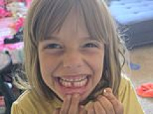 California girl, 7, is SCALPED by pack of six vicious stray dogs while playing outside