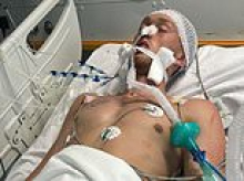 Brit tourist, 20, fights for life with devastating brain injury after quadbike crash on Greek holiday