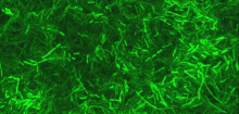Antibiotika: Extreme Resistenz laut Studie durch Umweltbakterien ausgelöst