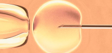 Kinderwunsch: Wenig Evidenz für gängige Vorbereitungstechniken beim Embryotransfer