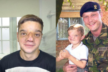 Pogledao je malog Stefana (4) i promenio mu sudbinu zauvek! Britanski vojnik dao novo lice srpskom dečaku: 