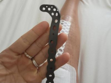 Federica Brignone uspešno prestala operacijo
