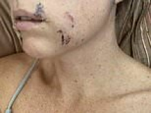 Arizona mother mauled by coyote while bravely fighting animal off four-year-old daughter