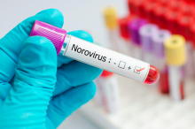 NIJZ potrdil, da je za prebavne težave učencev kriv norovirus