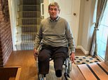 Pensioner is forced to have both legs amputated after medics took 29 appointments to diagnose common condition