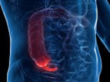 Inside the rise of appendix cancer in under-50s as statistics show a dramatic increase in the number of young and middle-aged people being diagnosed