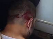 Dentist who helped save stabbed Flydubai pilot reveals 'extremist hijacker' repeatedly begged 'kill me' - as new footage emerges of him