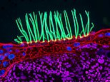 Huge row over microscope photograph contest winner's 'AI fake' video