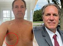 What happens in Vegas: Man says friend's nipple twisting on vacation led to breast cancer discovery