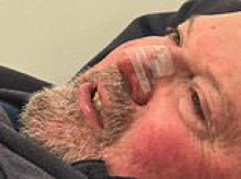 Aussie's warning to check your kitchen after he was injured when a cold can of soup exploded in his face