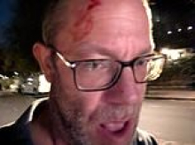 Jewish man 'attacked by activists when he tried to stop them graffitiing' - as police launch anti-Semitic hate crime probe