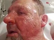 Spinal injury patient recalls horror of being allegedly doused in petrol and set on fire at Sydney's Prince of Wales Hospital
