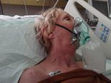 Aussie grandmother fighting for life after freak accident while on holiday in Bali as family desperately seek funds to help pay for massive medical bills
